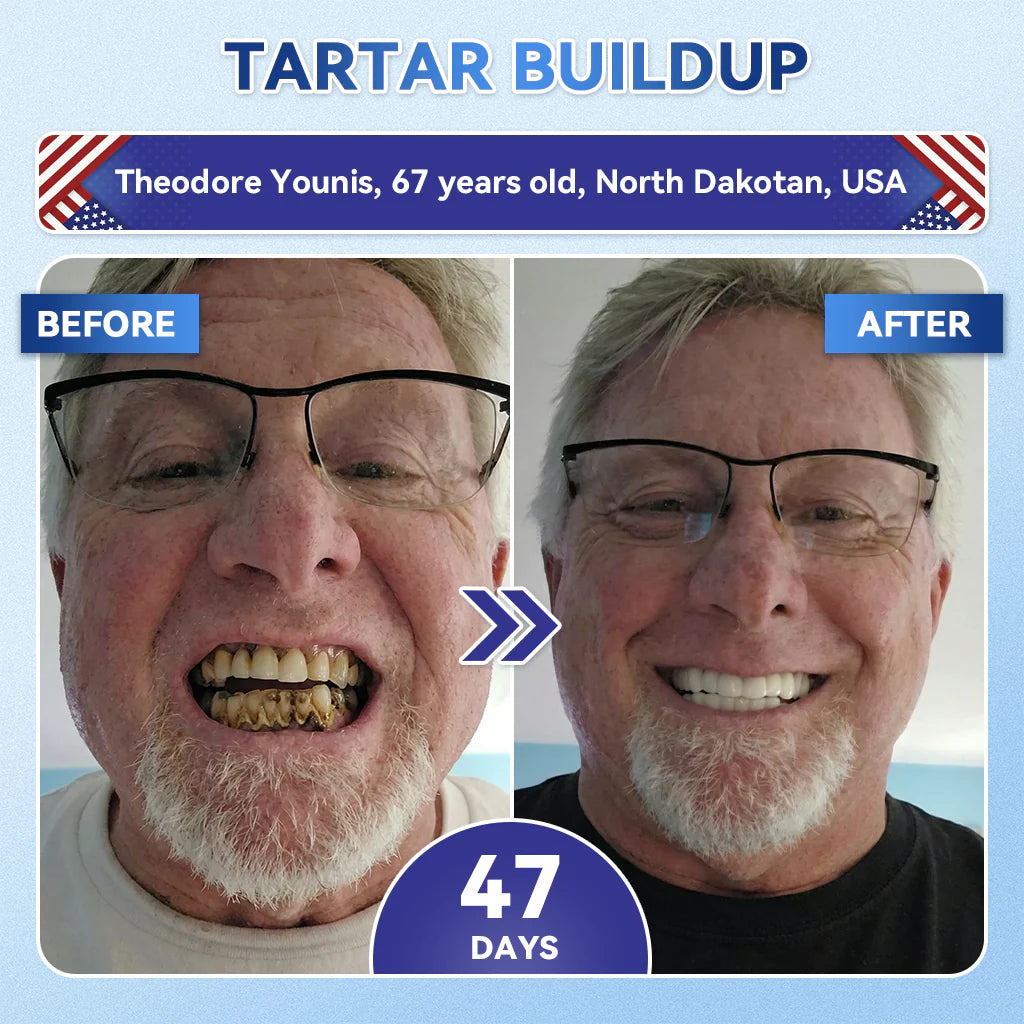 Deep Whitening Toothpaste