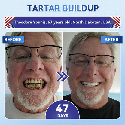 Deep Whitening Toothpaste