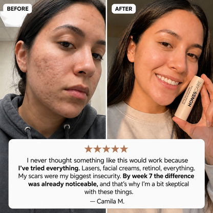 Acne Scar Remodeling Stick™