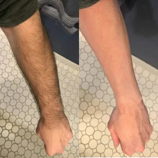 Honescare Pain-Free Hair Removal Cream