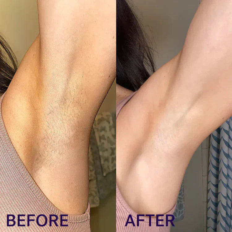 Honescare Pain-Free Hair Removal Cream