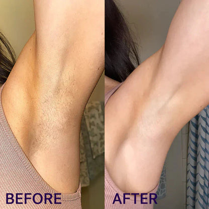 Honescare Pain-Free Hair Removal Cream