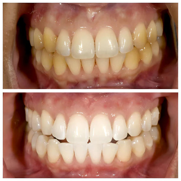 Deep Whitening Toothpaste