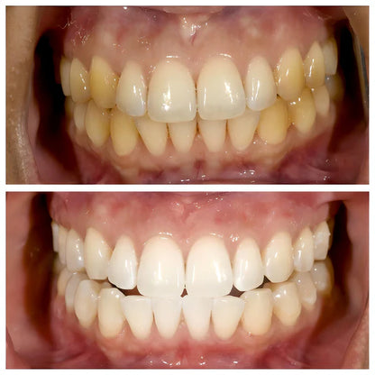 Deep Whitening Toothpaste