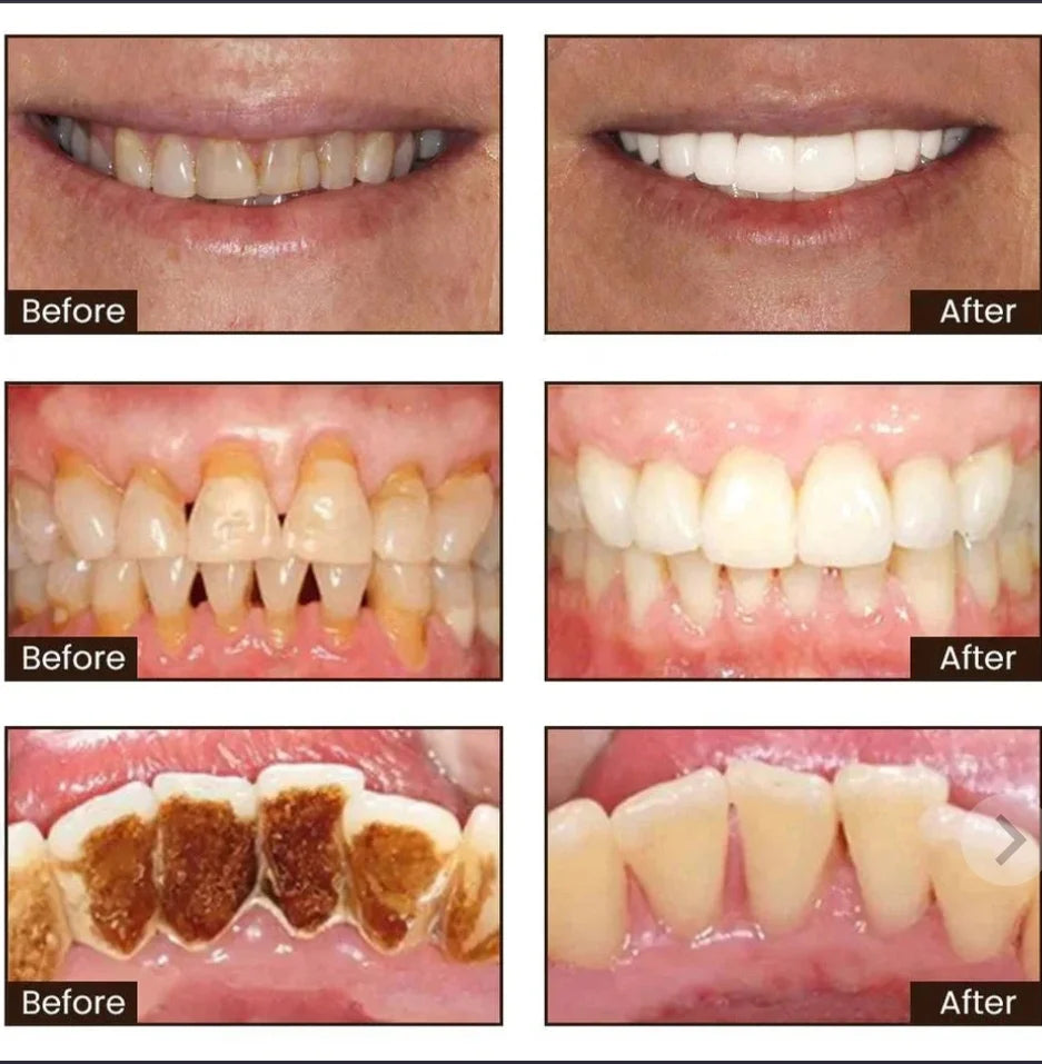 Deep Whitening Toothpaste